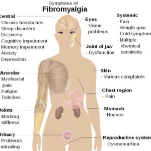 Internationella Fibromyalgidagen